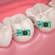 Image for article titled Who Wants a Tooth That Tells Your Doctor When You Drink or Smoke?